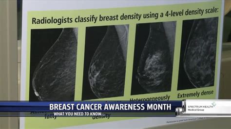 Mammograms Are Key To Detecting Early Breast Cancer