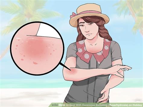 How To Deal With Excessive Sweating Hyperhydrosis On Holiday