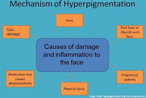 Post Inflammatory Hyperpigmentation Know How To Treat It