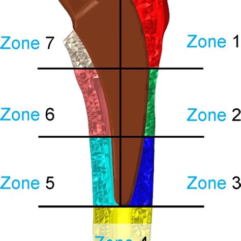 Seven Volumes Of Interest Vois Based On The Gruen Zone The Bone