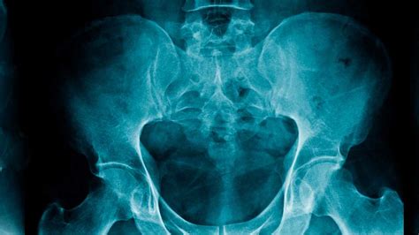 What You Can Do About Sacroiliac Joint Pain | SpineOne