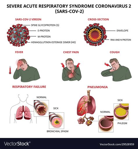 Coronavirus Symptoms Royalty Free Vector Image