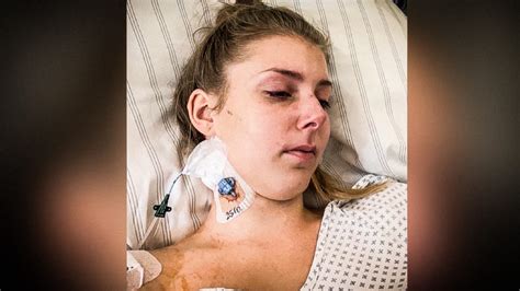 Auch ist es möglich, dass der baum als naturdenkmal gilt. Baum fällt auf 16-Jährige | SAT.1 NRW - Die Infopage zur ...