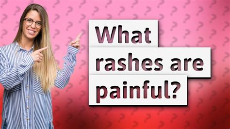 What Rashes Are Painful Youtube