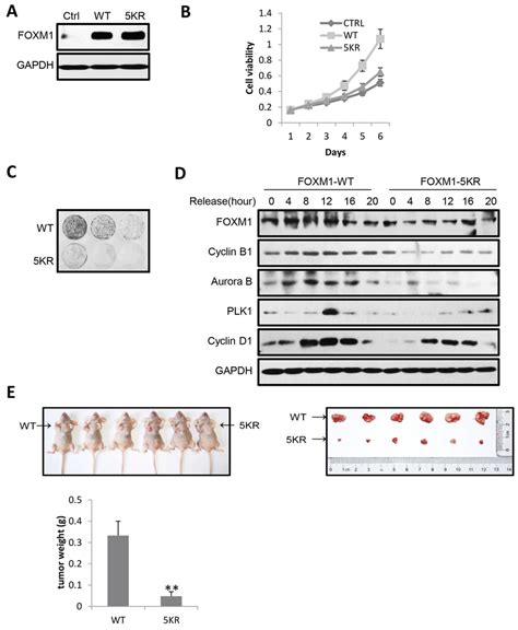 Acetylation Of FOXM1 Promotes Cell Proliferation Cell Cycle