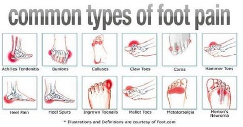 Types Of Foot Pain And How To Get Rid Of It