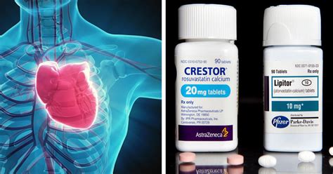 Treatment depends on the cause of galactorrhea. Taking Cholesterol-Lowering Drugs Can Cause THESE 4 ...