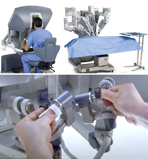 Robotic Prostate Cancer Surgery Saint Johns Cancer Institute
