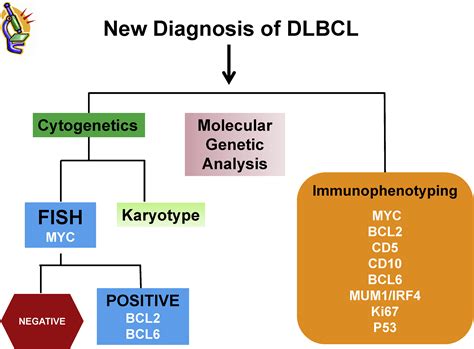 Diffuse Large B Cell Lymphoma Pathology