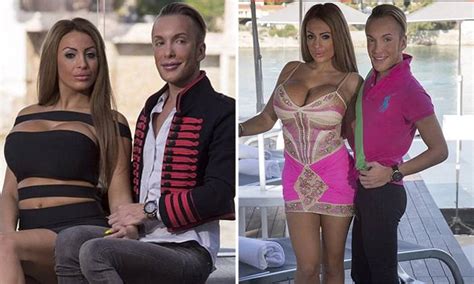 Couple Spend 300000 On Surgery To Look Like Their Idols Barbie And Ken