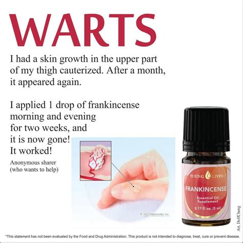 Frankincense To Remove Warts Essential Oils 2 Essential Oils