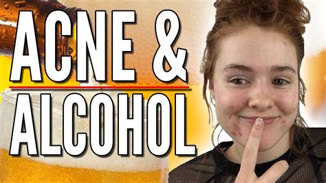 Alcohol And Liquor Is Bad For Your Skin And Can Cause Acne Youtube