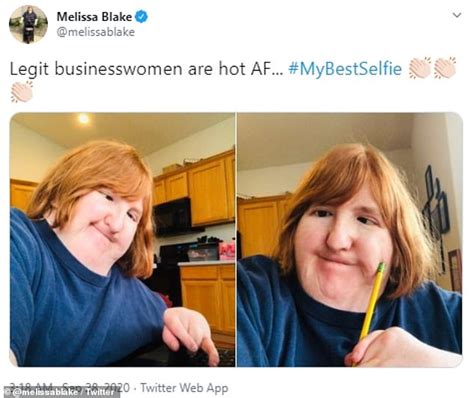 Woman Who Was Told She Is Too Ugly To Post Photos Of Herself Shares A