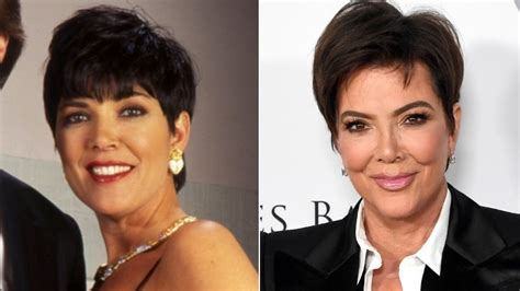 Kris Jenner Had A Stunning Plastic Surgery Transformation