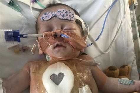 Baby Born With Half A Heart And Given ‘no Chance Of Survival Is Now