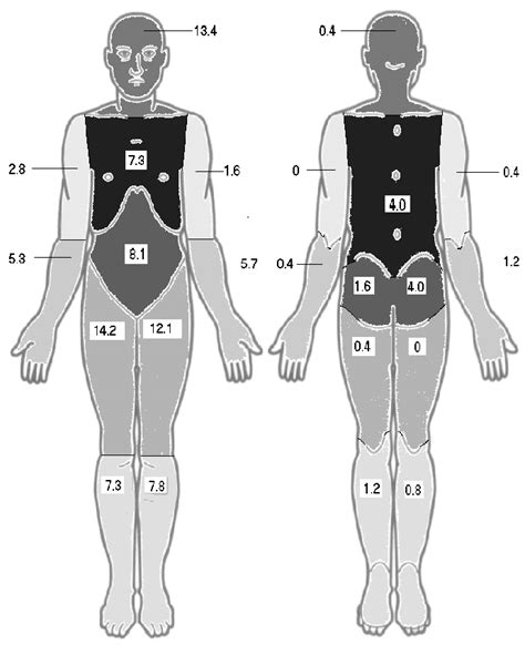 Distribution Of Gunshot Wounds Values Shown Are A Percentage Of The