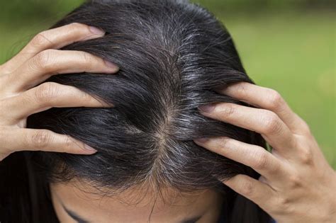 How To Tell If Your Losing Hair A Guide Luxe Beat Magazine