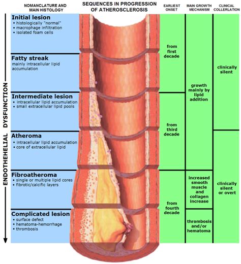 Atherosclerosis Causes Symptoms A Level Biology Notes