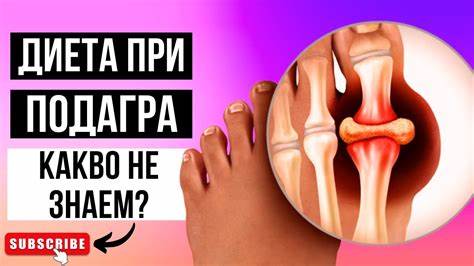 ПОДАГРА И ПОВИШЕНА ПИКОЧНА КИСЕЛИНА - ПОЛЕЗНИ СЪВЕТИ, ДИЕТА И ПРИМЕРНО Картинка - ПОДАГРА И ПОВИШЕНА ПИКОЧНА КИСЕЛИНА - ПОЛЕЗНИ СЪВЕТИ, ДИЕТА И ПРИМЕРНО