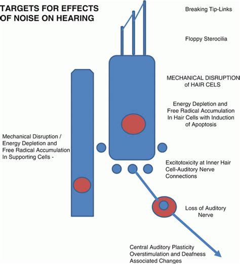 Basic Mechanisms Underlying Noise Induced Hearing Loss Basicmedical Key
