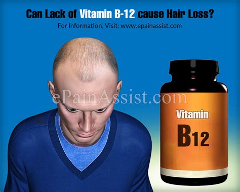 top 125 b12 deficiency hair loss reversible vn