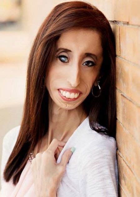 Lizzie Velasquez Cyber Bullied As A Teen Called The Ugliest Woman In