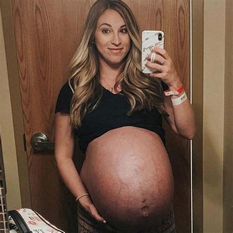 Mom Of Quadruplets Shares Awe Inspiring Before And After Pregnancy