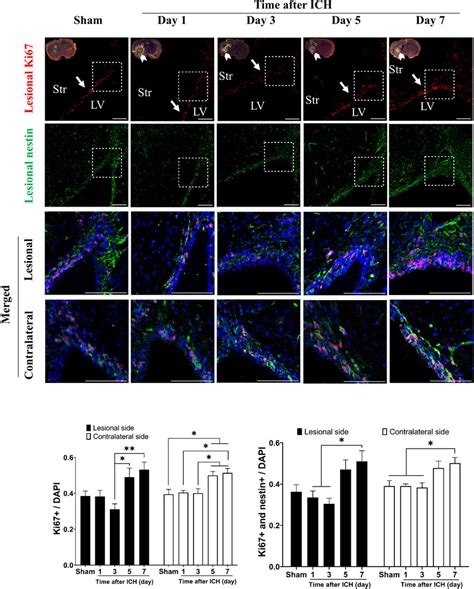 Proliferation Of Neural Stem Cells Nscs In Subventricular Zone Svz