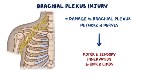 Brachial Plexus Injury Nursing Osmosis Video Library