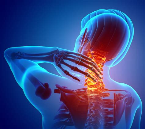 A buildup of fat between the shoulder blades causes a hump in the back of the neck to form. Pain in the back of the neck: causes, Treatments and home ...