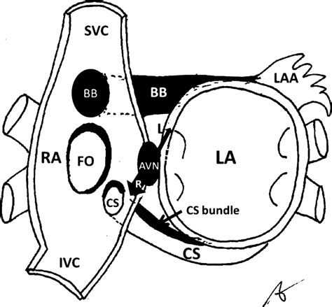 Schematic Frontal Cross Section Of The Atria Centered On The
