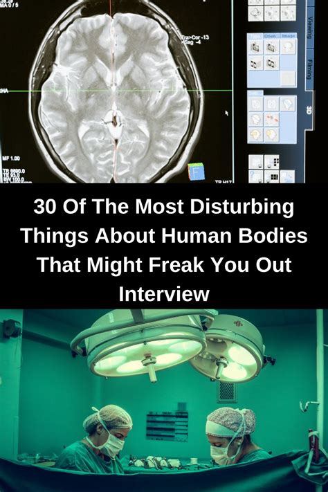 30 Of The Most Disturbing Things About Human Bodies That Might Freak