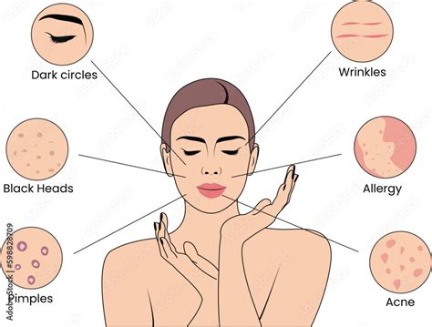 Vector Art Depicting Various Skin Issues Vector Based Guide To Skin