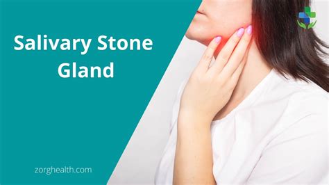 Salivary Stone Gland Causes Symptoms And Surgery Zorg Health