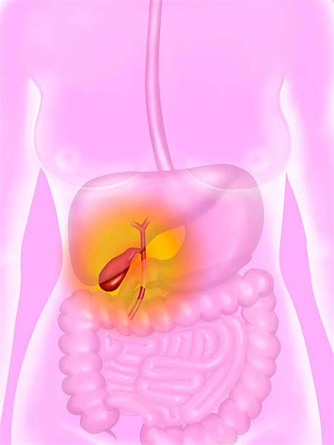 Gallbladder Pain What Are The Symptoms Of Gallbladder Trouble