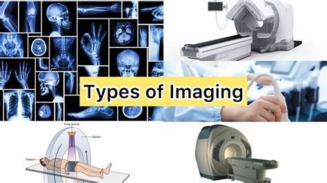 Types Of Imaging Modalities From X Ray To Mri Youtube