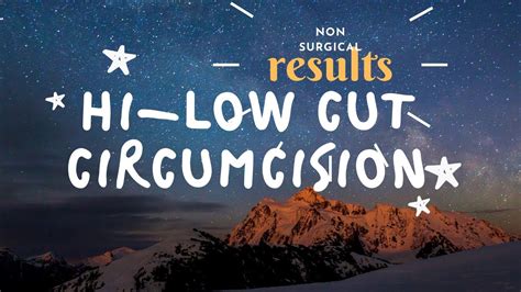 How Are The Results Of Hi Vs Low Vs Standard Cut Circumcision Drsachin Kuber Call Us
