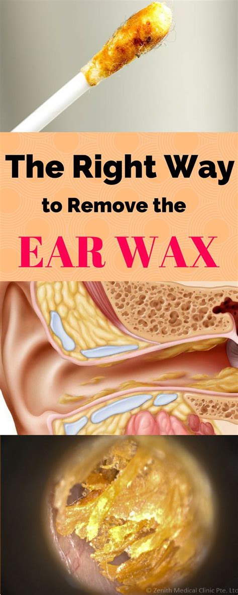 Jun Ear Wax Ear Cleaning Wax Healthy Tips