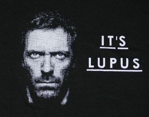 Its Never Lupus Except When It Is Lupus Lupus Awareness