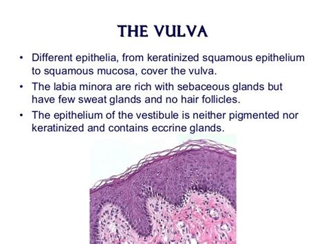 Benign Diseases Of The Vulvavagina And Copy