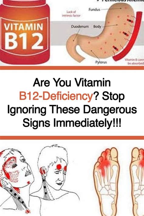 Healthy 8 Are You Vitamin B12 Deficiency Stop Ignoring These