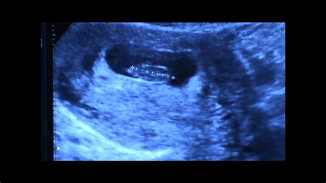 8 Week 4 Day Ultrasound Youtube