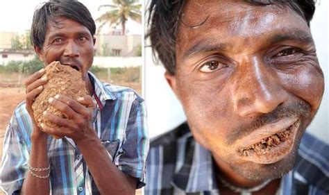 Video Man With Bizarre Eating Disorder Eats Three Kilos Of Bricks Gravel And Mud A Day Weird