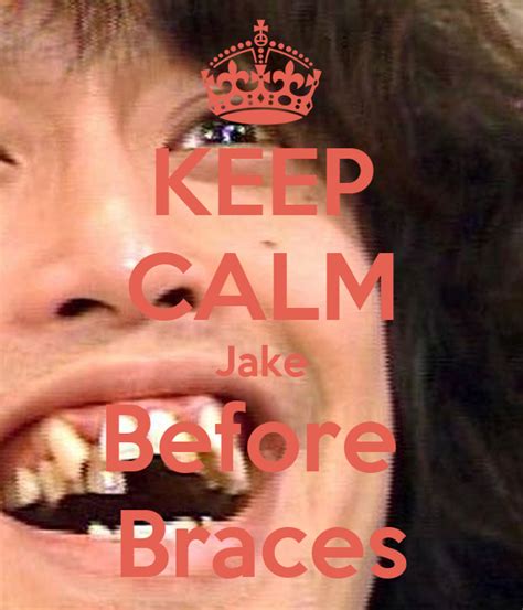 Keep Calm Jake Before Braces Poster Sham Keep Calm O Matic