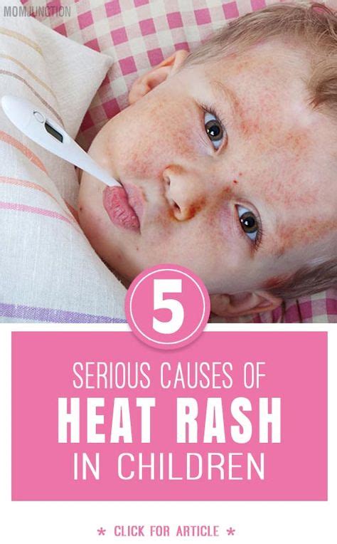 7 Best Rashes In Children Images Children Future Baby Rashes In