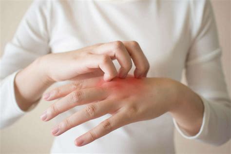 Itchy Skin 10 Home Remedies For Itchy Skin