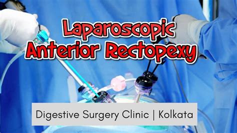 Laparoscopic Anterior Rectopexy Digestive Surgery Clinic Youtube