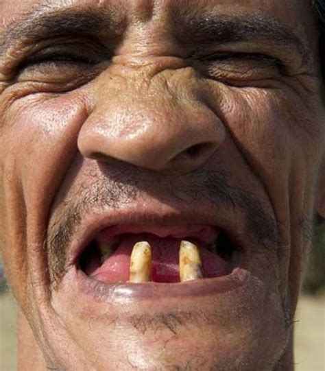 Funny Old Man With No Teeth