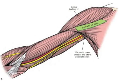 Anterior Approach To Humerus Shaft