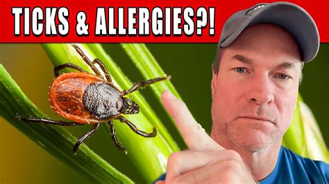 Ticks Can Trigger Red Meat Allergies Alpha Gal Youtube